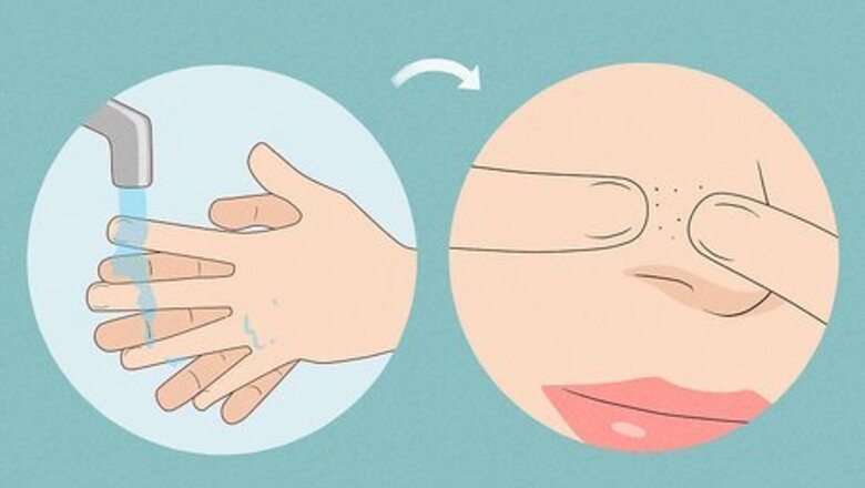 How to Remove Blackheads