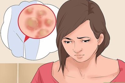 How to Cure Genital Warts in Women