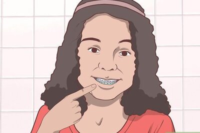 How to Cope With Braces As a Teenager