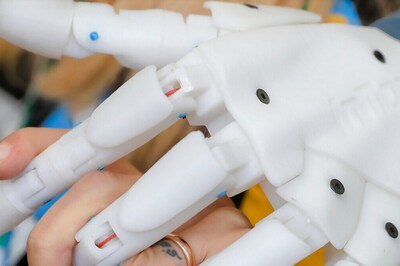 IIT Kanpur Alumnus Designs Prosthetic Hand That Can Be Charged Like A Mobile Phone