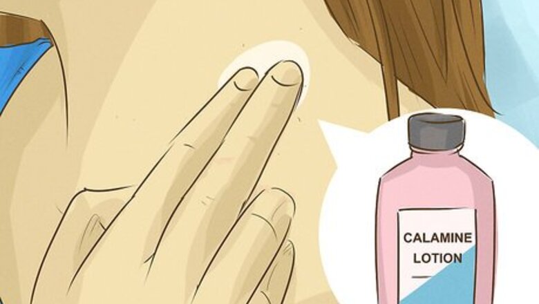 How to Heal Eczema Fast
