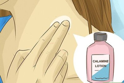How to Heal Eczema Fast