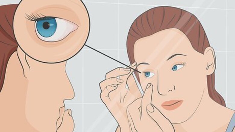 How to Treat an Eye Infection Naturally