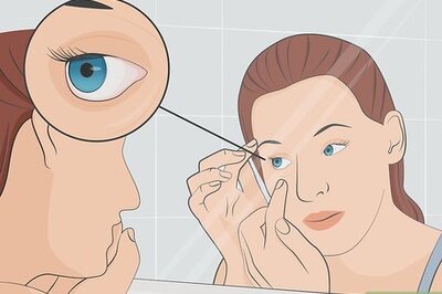 How to Treat an Eye Infection Naturally