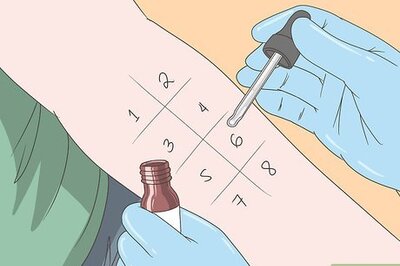 How to Avoid Triggers for Chronic Hives