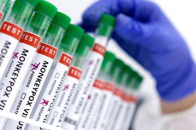 Similar Symptoms, Less Fatal: How Monkeypox is Different from Smallpox and Chickenpox