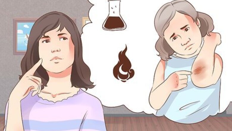 How to Treat Burns in Children