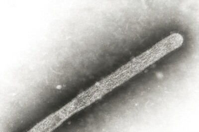 US Reports Second Human Case of Bird Flu Linked To Country's Dairy Cow Outbreak