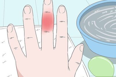 How to Cure an Infected Finger