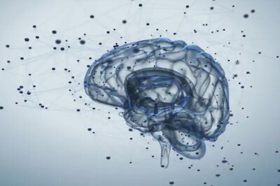 All You Need to Know About Brain Aneurysms