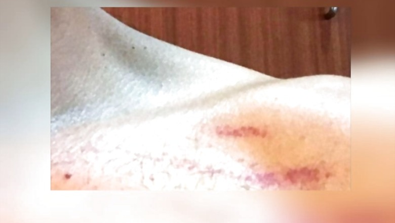 Cab Driver, His Colleagues Thrash Passenger for Questioning Why Seatbelt Buckle was Missing