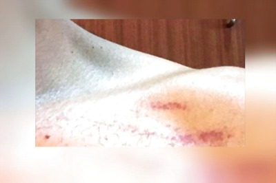 Cab Driver, His Colleagues Thrash Passenger for Questioning Why Seatbelt Buckle was Missing