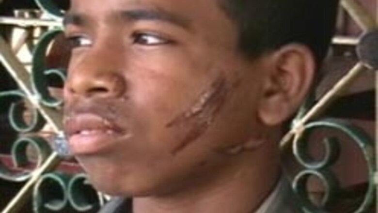 12-yr-old attacked for eating biscuit without permission