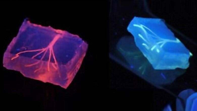 3D-printed blood vessels coming soon