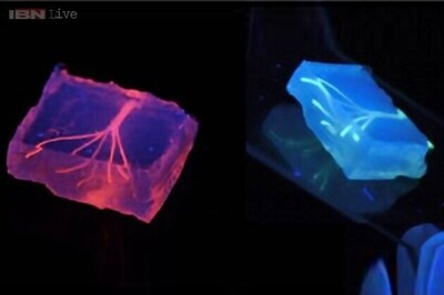 3D-printed blood vessels coming soon