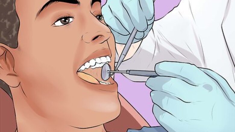 How to Treat Oral Thrush