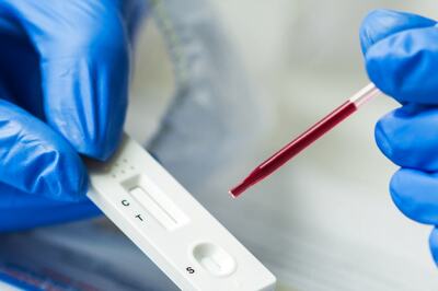 87% People in Tamil Nadu Have Antibodies Against Covid-19, Says Sero Survey