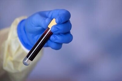 Nearly 8% of people in German coronavirus hotspot had COVID-19 - RKI