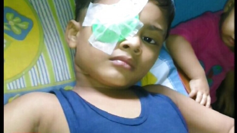 Mumbai: Class 1 student loses vision in one eye after classmate hits him with a pair of scissors