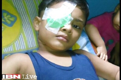 Mumbai: Class 1 student loses vision in one eye after classmate hits him with a pair of scissors