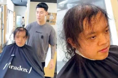 Watch: California Barber Gives Complete Makeover To Man With Hair Loss