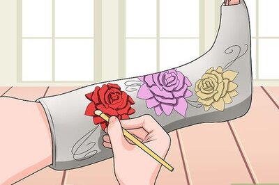 How to Have Fun With a Broken Leg