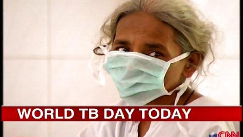 Drug resistant tuberculosis on the rise