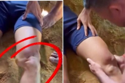 Watch: Man Fixes Dislocated Knee Within Seconds