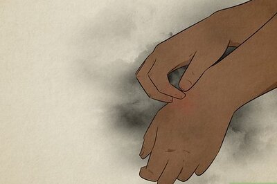 Itchy Left Hand: What Does It Mean and What Should You Do about It?