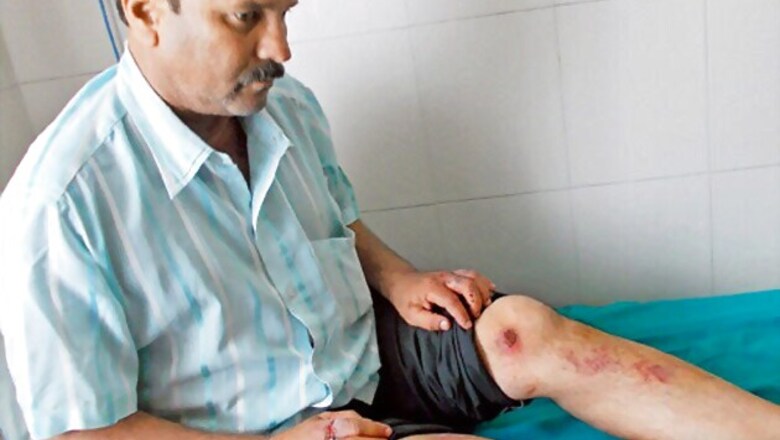 Pune: Cops rescue man tortured by wife for property