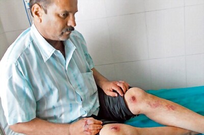 Pune: Cops rescue man tortured by wife for property