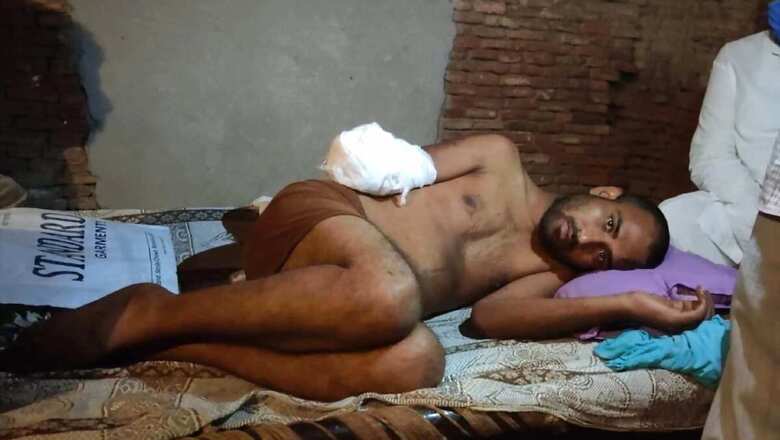 Panipat Man Says Hand Chopped Off for '786' Tattoo, Family Denies Claim He Sexually Assaulted Minor Boy