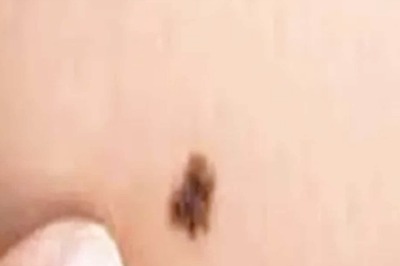 This 20-Year-Old Died of Melanoma. Family Now Fulfilling His Last Wish