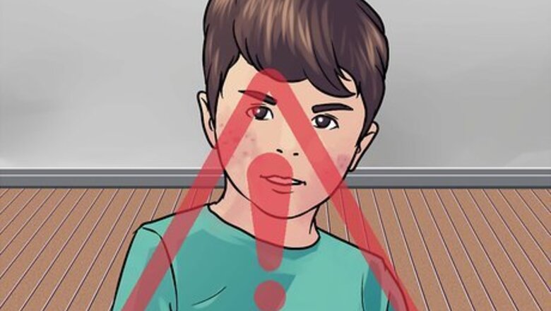 How to Cure Scarlet Fever