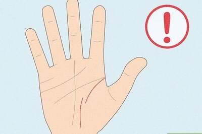 What Does a Broken Life Line on Your Palm Mean?