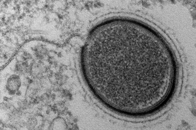 'Zombie' Viruses Frozen in Arctic Permafrost Could Be Freed as World Warms, Trigger Deadly Pandemics