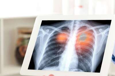 Leaking Lungs, Seeping around Heart: 47-yr-old Woman Beats All Odds to Defeat Covid