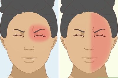 How to Relieve & Prevent Headaches & Migraines Fast