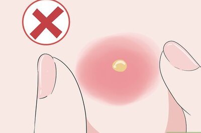 How to Cure Boils: Can Natural Remedies Help?