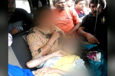 Acid Attack on Girl in Bihar's Aurangabad, Boy Still At Large