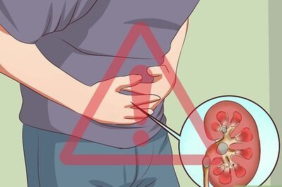 How to Diagnose Kidney Stones
