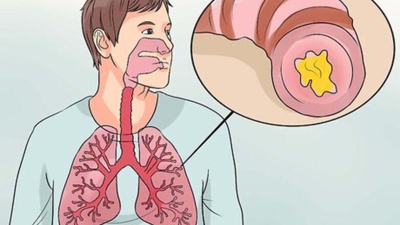 How to Recognize Bronchitis Symptoms