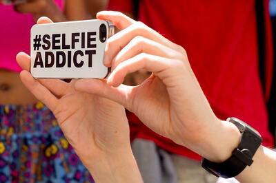 Beware! 'Selfie elbow' Is Now A Real Medical Condition