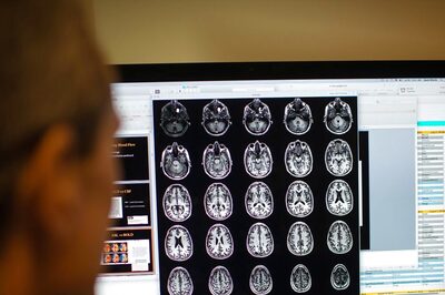 Alzheimer’s Disease Care: Early Detection And New Screening Methods