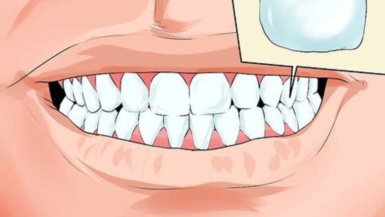 How to Avoid Dental Crown Problems
