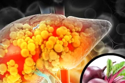5 Foods To Consume If You Have A Fatty Liver Problem