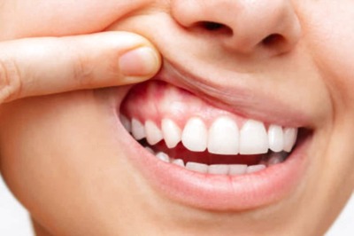 Here Is What You Should Be Doing If You Want Healthy Gums