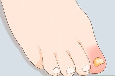 7 Ways to Treat a Swollen Toe & Relieve Pain at Home